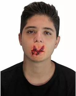 Cut Lips Appliance Kit